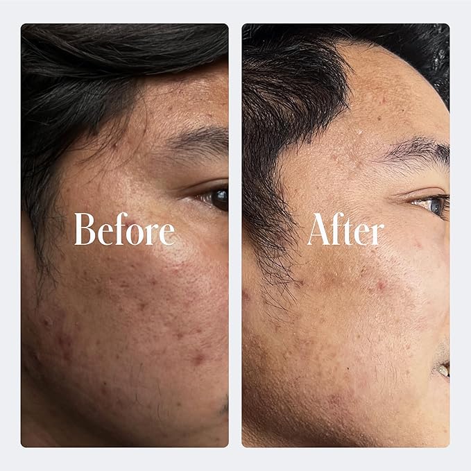 Geologie Retinol Anti-Aging Face Cream | Enhanced .2% Retinol Formula for Effective Results | Reduce Fine Lines & Wrinkles | Protect & Repair Skin With Hyaluronic Acid & Niacinamide | For Men & Women-Velvo Beauty