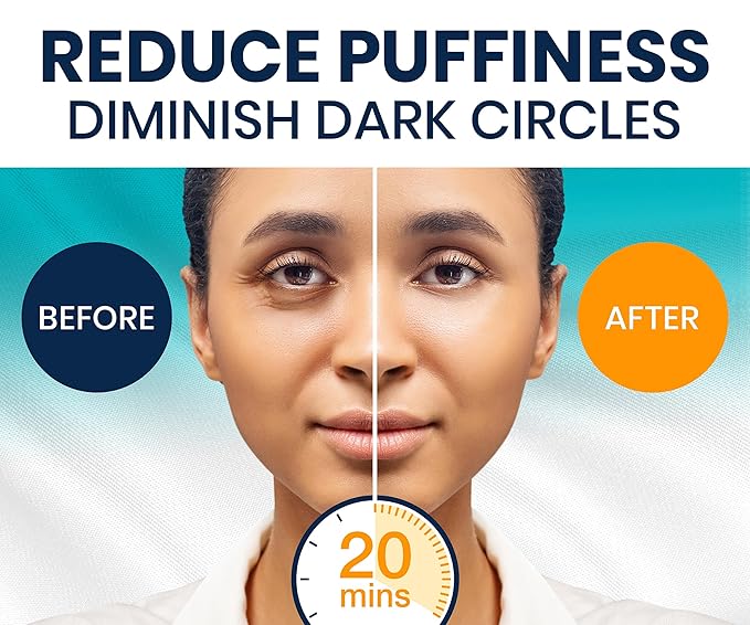 Stylia Under Eye Patches for Puffy Eyes and Dark Circles (30 Pairs) - Marine Collagen Under Eye Mask with Vitamin C, Hyaluronic Acid, Pearl Extract - Eye Masks for Dark Circles and Puffiness-Velvo Beauty