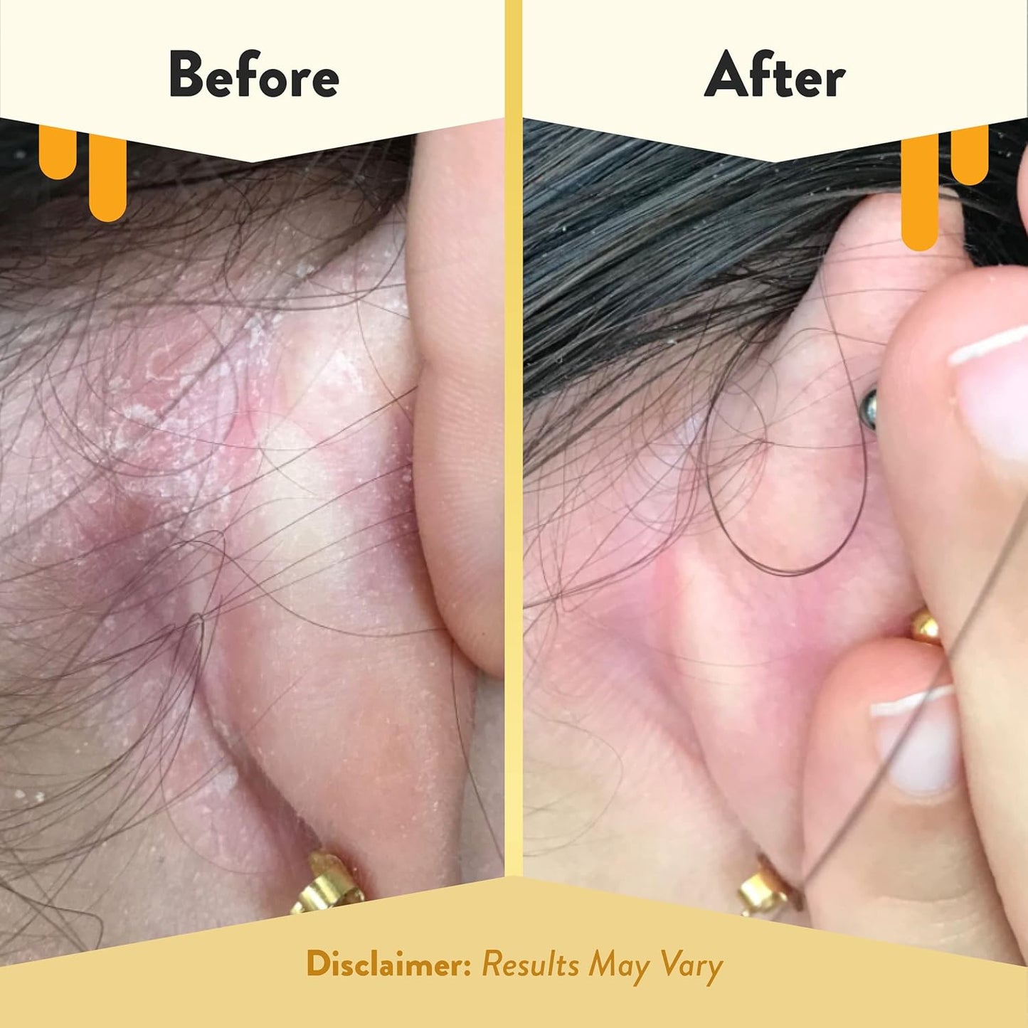 ECZEMA HONEY Gentle Face & Body Lotion Stick - Moisturizing Colloidal Oatmeal Hand Cream for Extremely Dry Skin - Eczema Lotion Helps Psoriasis, Dermatitis & More (2.2 Oz)-Velvo Beauty