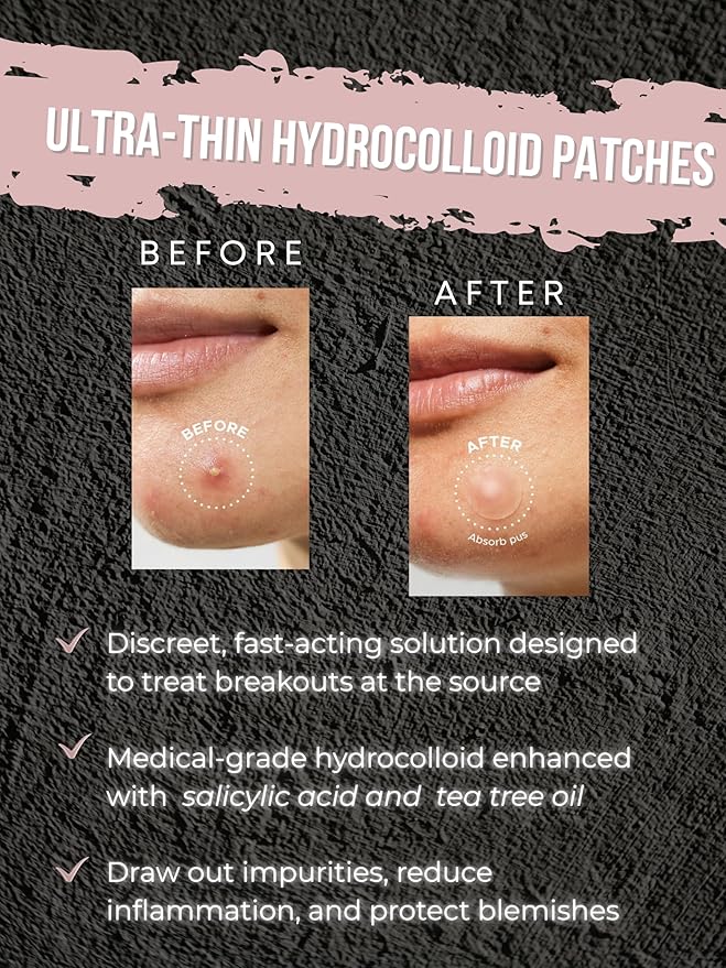 Acne Patch Ultra Thin Invisible Spot Cover- Fast Acting Hydrocolloid Pimple Patch with Salicylic Acid, Centella Asiatica & Tea Tree Oil- 72 Ct. Effective Treatment Absorbs Zits and Blemishes-Velvo Beauty