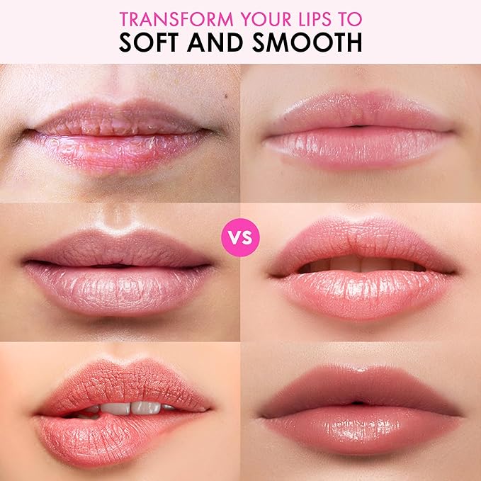 Lip Mask Overnight - Lip Sleeping Mask and Lip Scrub Exfoliator, Scrubber, Moisturizer, Balm and Hydrator for Lip Care, Therapy, Butter, Repair and Treatment for Dry, Cracked Lips-Velvo Beauty