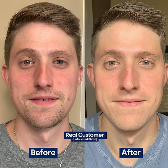 Strive - Fresh Face Jojoba Scrub - Mens Face Scrub, Fragrance Free, Smooth, Clear Skin, Refreshing with Aloe Vera, Centella Asiatica, Hyaluronic Acid & Niacinamide - For All Skin Types - 30 ML-Velvo Beauty