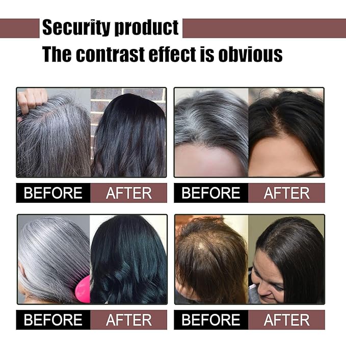 3PCS Hira Darkening Polygonum Shampoo Bar for Gray, Thinning Hair and Hair Growth (he shouwu) - Soap Bar-Velvo Beauty