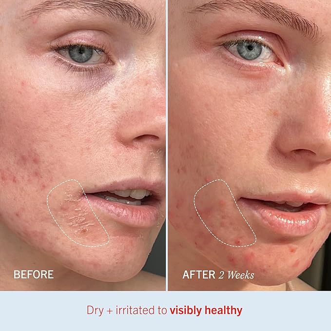 First Aid Beauty - Ultra Repair Cream, Intense Hydration Whipped Colloidal Oatmeal, Clinically Proven to Strengthen Skin Barrier in 7 Days & Helps Relieve Eczema, Luxury Face & Body Moisturizer, 12 oz-Velvo Beauty