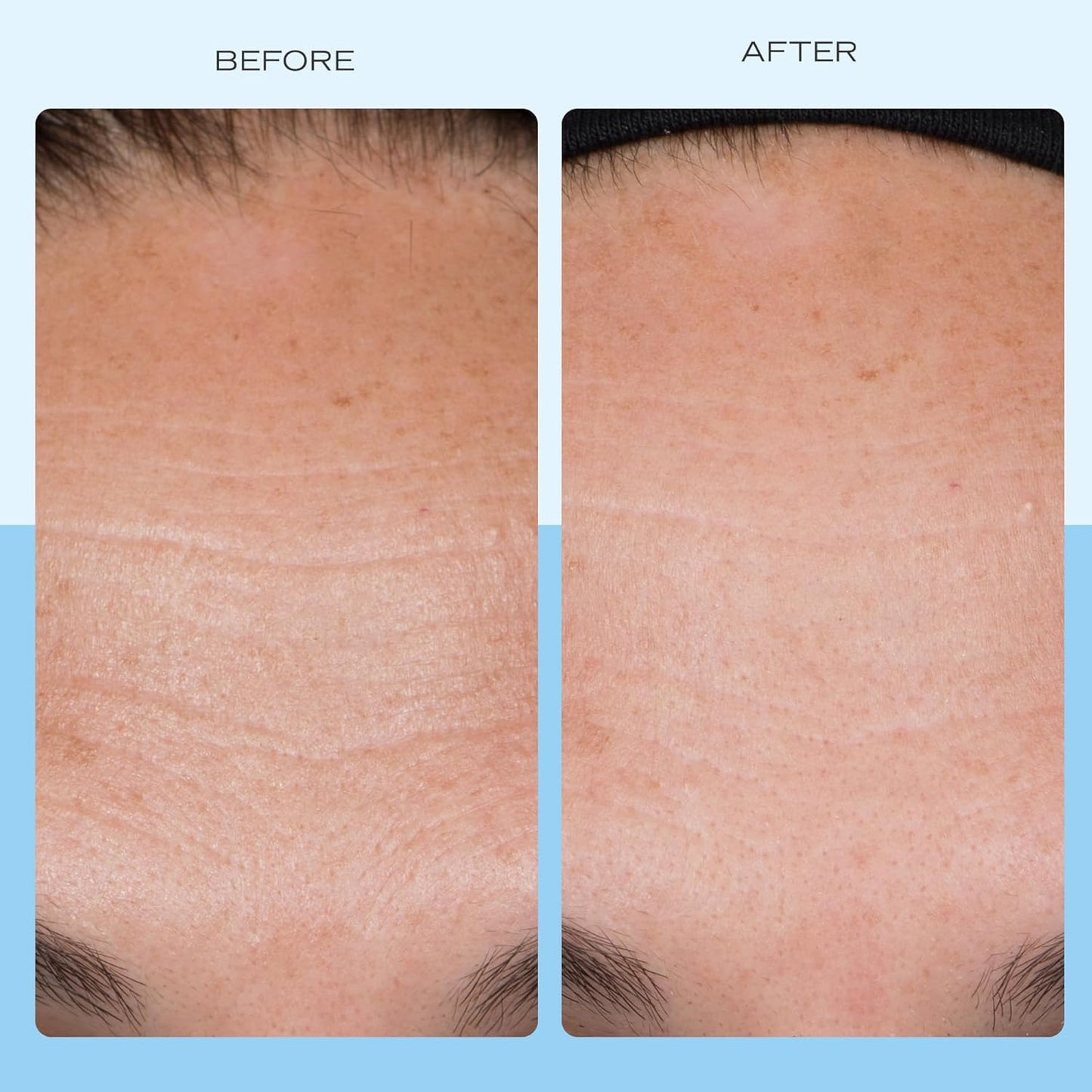 First Aid Beauty - Firming Collagen Cream with Peptides & Niacinamide, Ultra-Rich Plumping Moisturizer, Hydrates & Visibly Firms, Non-Comedogenic, Safe for Sensitive Skin, 3.5 oz-Velvo Beauty