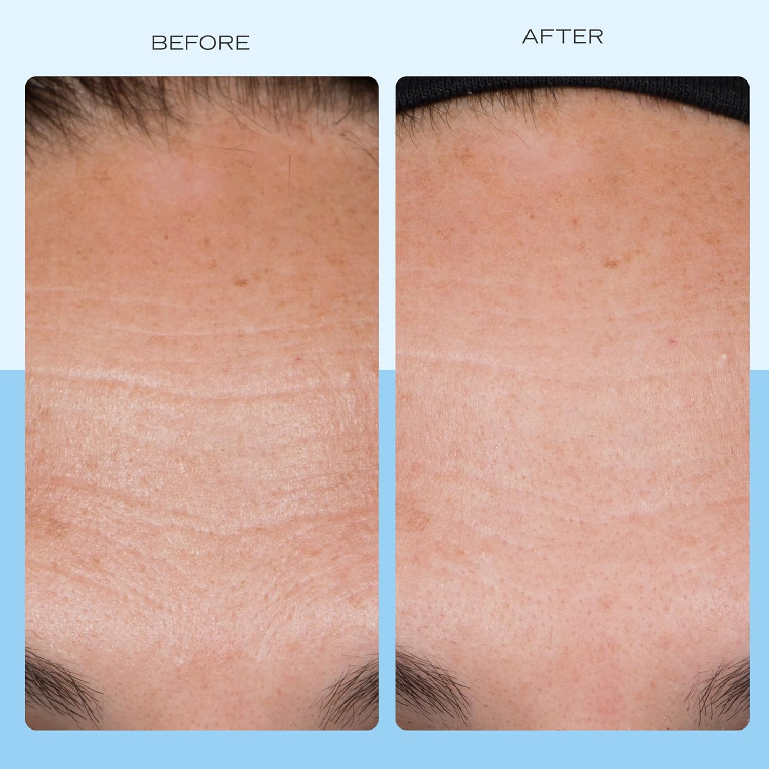 First Aid Beauty - Firming Collagen Cream with Peptides & Niacinamide, Ultra-Rich Plumping Moisturizer, Hydrates & Visibly Firms, Non-Comedogenic, Safe for Sensitive Skin, 3.5 oz-Velvo Beauty