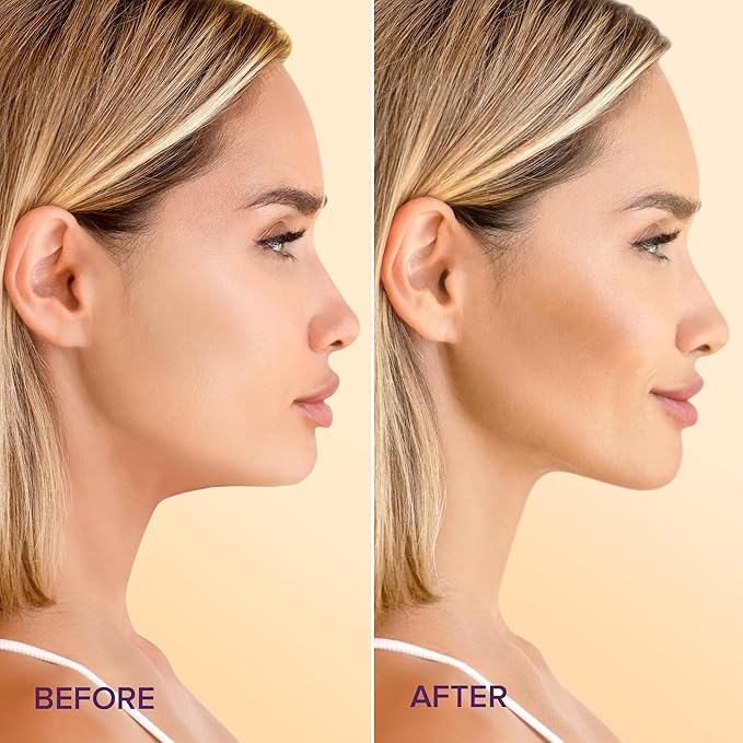 MAREE V Line Lifting Mask with 24K Gold – Deep Collagen Face Mask for Women – Jawline Shaper Mask with Retinol & Hyaluronic Acid – Neck Tightening & Firming - Double Chin Strap for Face Lift-Velvo Beauty