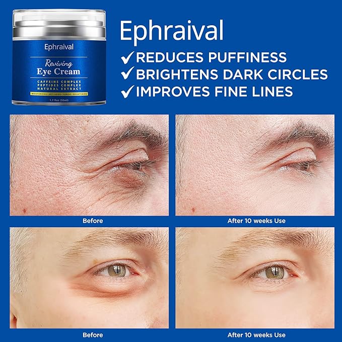 Men's Eye Cream, Eye Cream for Dark Circles and Puffiness, Anti-aging Caffeine Eye Cream for Men, Brightens, Reduces Puffiness, Dark Circles, and Fine Lines, Eye Treatment for Men Women-Velvo Beauty