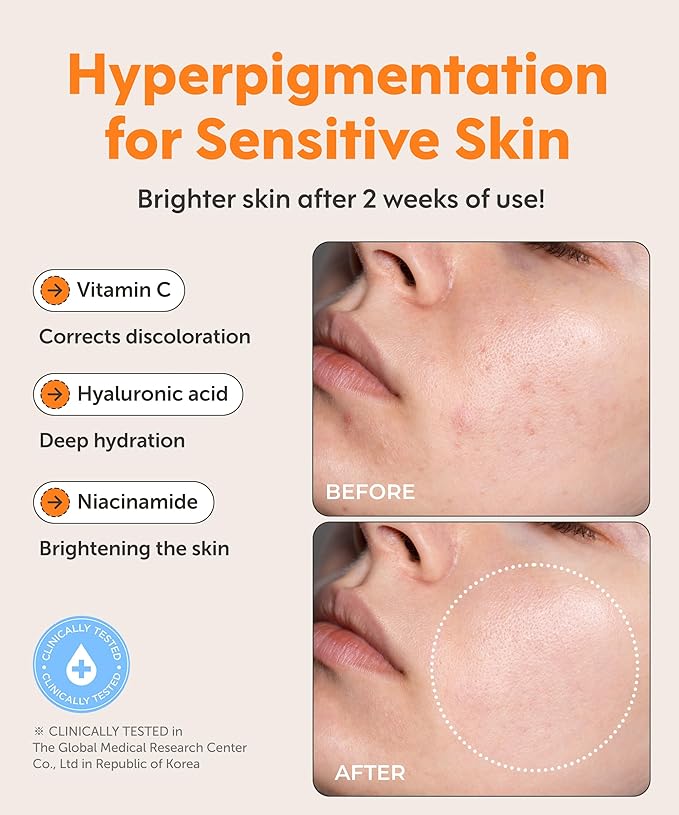 SERUMKIND Vitamin C Serum for Korean Face Skincare – Brightening for Dark Spots, Pore Refining, Discoloration Correcting – With Niacinamide – Reduces Fine Lines and Wrinkles-Velvo Beauty