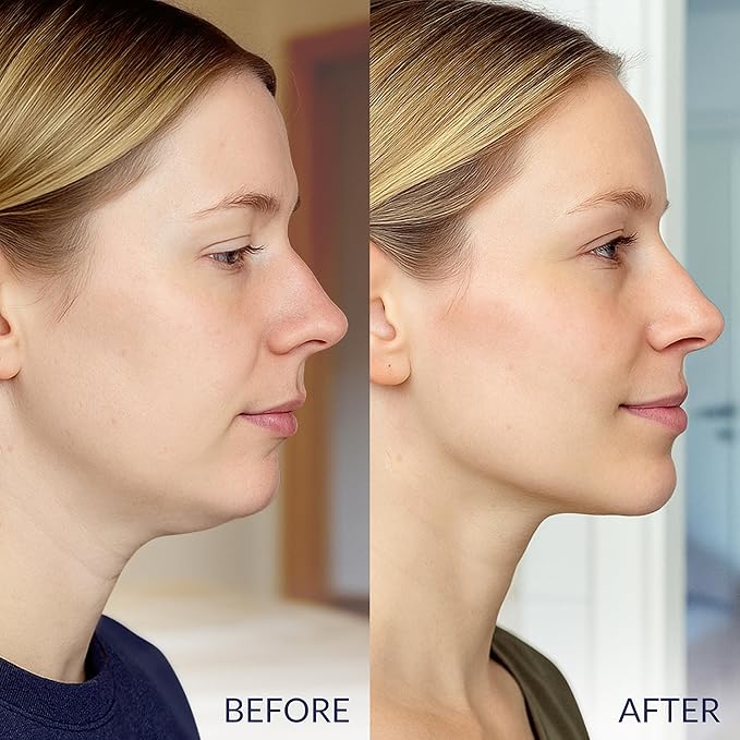 Stylia V Line Lifting Collagen Face Mask - Double Chin Strap for Women - Jawline Shaper Face Lift Tape - Neck Lift Collagen Mask - Chin Strap for Sleeping - Hyaluronic Acid, Aloe Vera, Cica 7P-Velvo Beauty