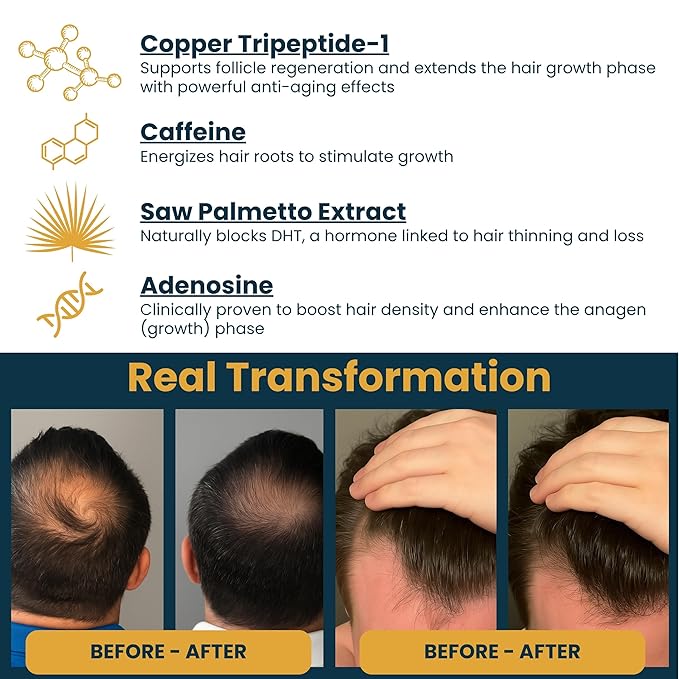 Copper Peptide Serum for Hair Growth - Caffeine, Niacinamide, Rosemary Oil, Saw Palmetto Hair Density Serum, Topical Tripeptide Scalp Care for Hair Thinning, Women & Men 1 fl oz-Velvo Beauty