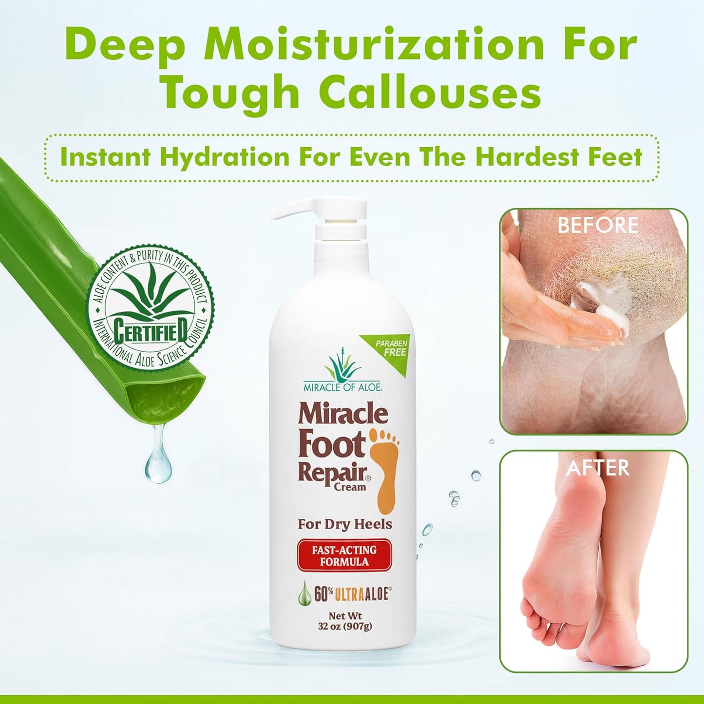 Miracle Foot Repair Cream (32 oz) Repairs Dry Cracked Heels and Feet, 60% Pure UltraAloe Moisturizes, Softens, and Repairs-Velvo Beauty