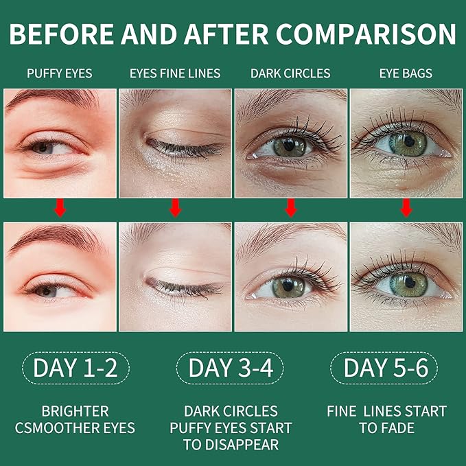 Green Seaweed Under Eye Masks (60 pcs),Eye Hydrolyzed Collagen Patches, Eye Gel Treatment Masks,Eye Pads for Dark Circles,Puffy Eyes,Under Eye Bags,Moisturizing,Anti-aging-Velvo Beauty