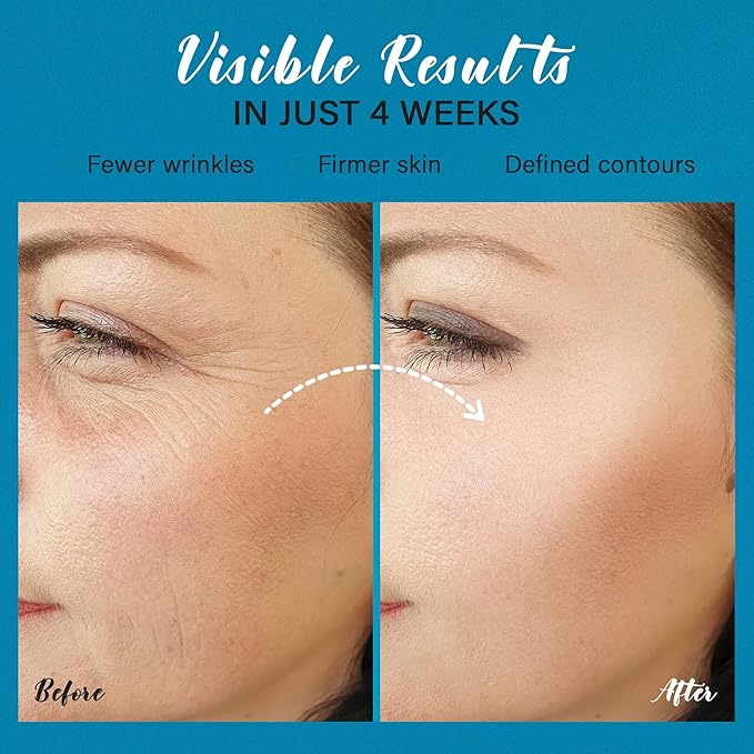 Tighten and Lift Neck Cream: Instant Face Lift Cream - 6-in-1 Anti-Aging Face Moisturizer for Anti-Wrinkle, Firm - Collagen, Retinol, Peptides & Hyaluronic Acid Neck Firming Cream for Skin Care-Velvo Beauty