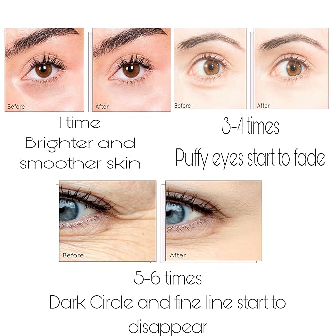 Under Eye Bags Treatment, Rose Eye Mask, Eye Treatment Mask, For Moisturizing,Revitalizing, Lift & Firm, Anti- Dark Circle, Depuffing. Cruety-Free. (60 Pieces)-Velvo Beauty