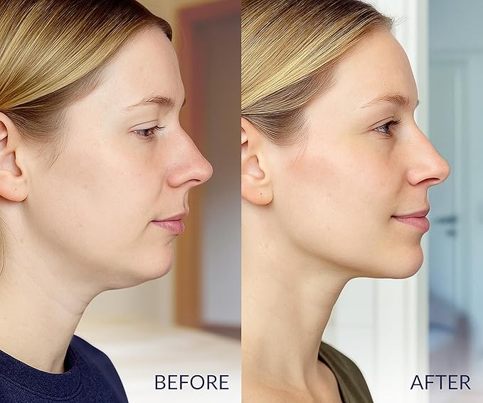 Stylia V Line Lifting Collagen Face Mask - Double Chin Strap for Women - Jawline Shaper Face Lift Tape - Neck Lift Collagen Mask - Chin Strap for Sleeping - Hyaluronic Acid, Aloe Vera, Cica 2PC-Velvo Beauty