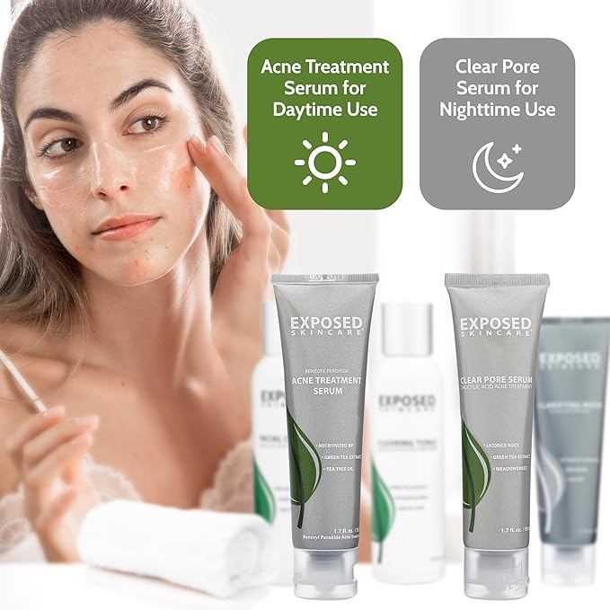 Exposed Skin Care Acne Treatment Kit - Includes Facial Cleanser, Clearing Tonic, Acne Treatment Serum, Clear Pore Serum, Clarifying Mask, Cloth - Natural Acne Solution for Face, All Ages & Skin Types-Velvo Beauty