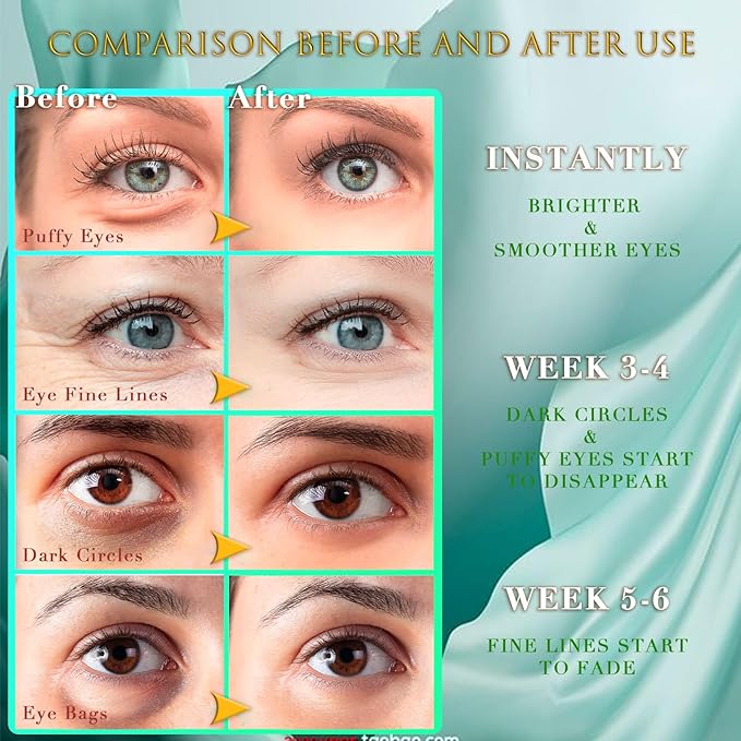 Green Seaweed Eye Mask– 60 Pcs - Gold Under Eye Mask Retinol & Collagen - Puffy Eyes and Dark Circles Treatments – Look Younger and Reduce Wrinkles and Fine Lines Undereye, Improve and Firm eye-Velvo Beauty