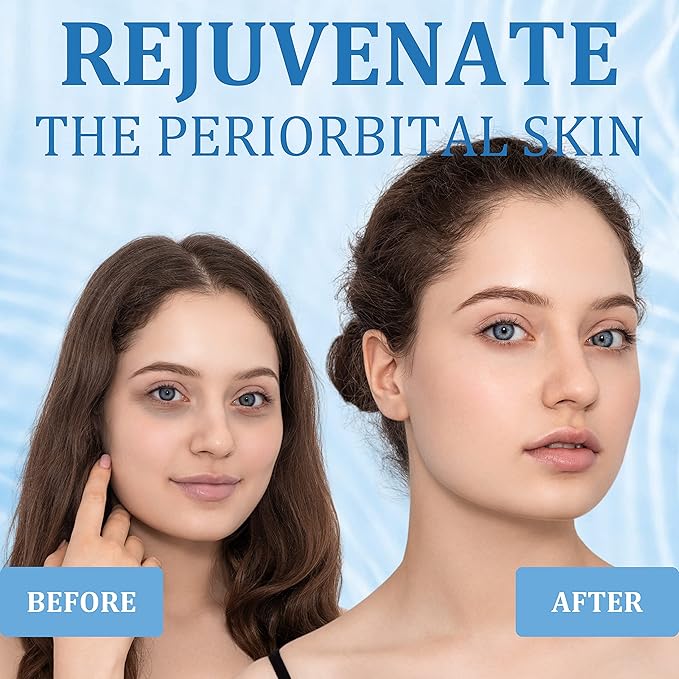 Under Eye Patches, Hyaluronic Acid Eye Mask, Collagen Eye Pads for Dark Circles, Eye Bags, Puffiness, Diminish Fine Lines and Wrinkles, Moisturize and Tighten Eye Skin for Men and Women-Velvo Beauty