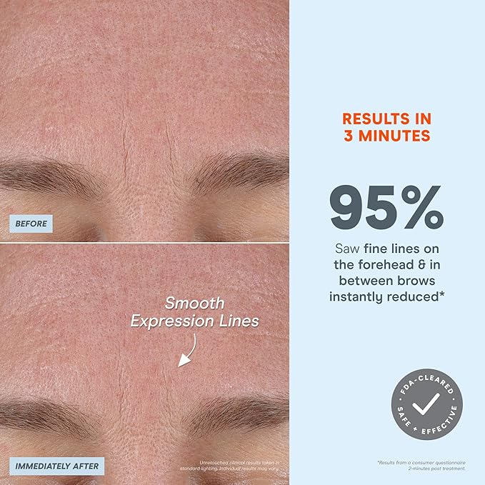 NuFACE FIX MicroWand Microcurrent Facial Device, FDA Cleared - Eyes, Lips & Lines Treatment with Serum Activator - Lip Plumper, Eye Depuffing Wand, Wrinkle & Smile Line Reducer, 3 On-the-Go Modes-Velvo Beauty