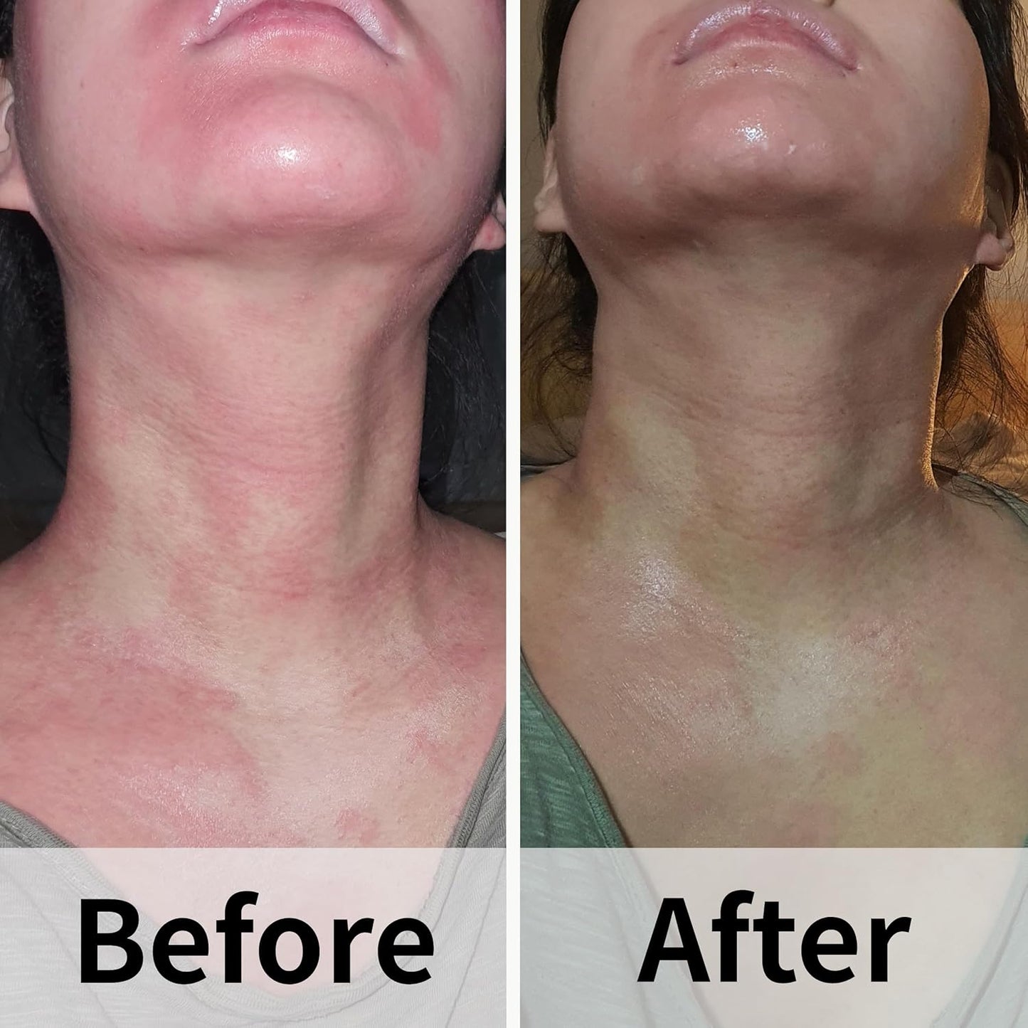 Ato Fast Calming Serum for Sensitive & Eczema-Prone Skin Instant Relief from Itch, Redness & Flare-Ups Powered by Cica & Panthenol 1.69 Fl Oz-Velvo Beauty