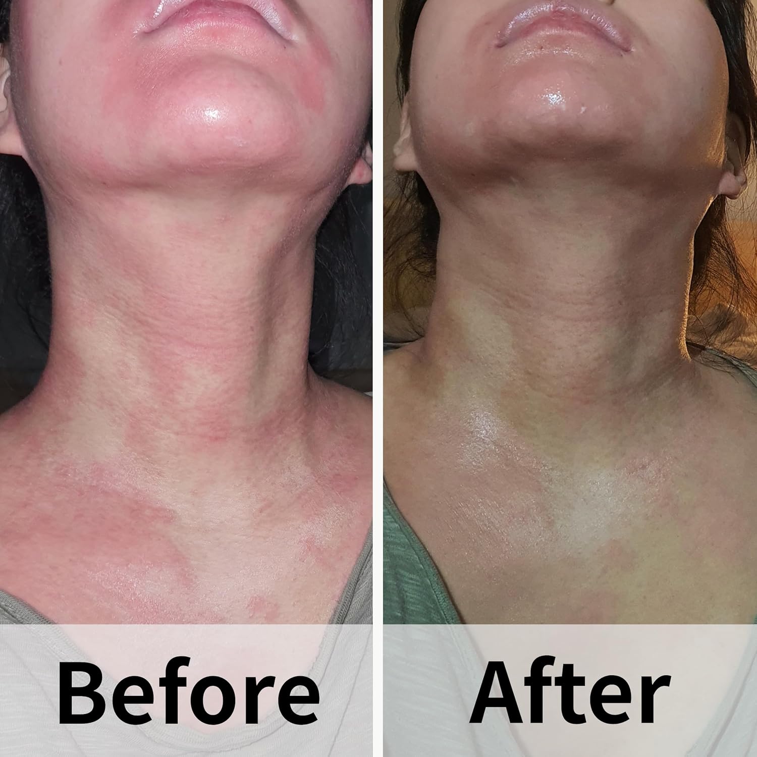 Ato Fast Calming Serum for Sensitive & Eczema-Prone Skin Instant Relief from Itch, Redness & Flare-Ups Powered by Cica & Panthenol 1.69 Fl Oz-Velvo Beauty