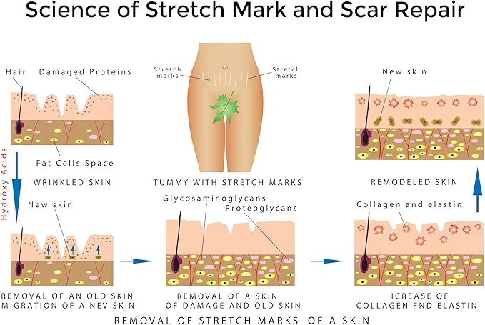Best Stretch Marks Cream Prevent & Reduce Marks Reduce Pregnancy Stretch Marks Highly Concentrated Cream includes $29 Scar Reducing Guide-Velvo Beauty
