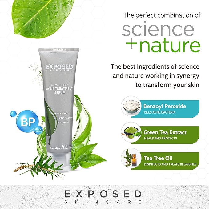 Exposed Skin Care Acne Treatment Serum Step 3 – Quickly Reduces Pimple Size and Redness - 12 Hour Spot Treatment - 3.5% Benzoyl Peroxide, Natural Green Tea & Tea Tree Oil-Velvo Beauty