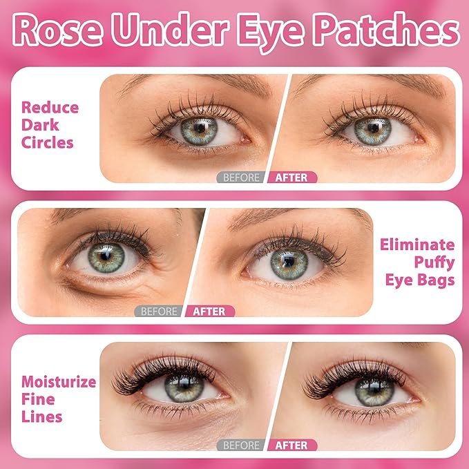 Eye Mask, Pink Rose Under Eye Patches (20 Pairs) Pink Rose Under Eye Masks Hyaluronic Acid Eye Patches for Dark Circles and Puffiness, Reduce Wrinkles and Fine Lines Under Eye Area - Pink-Velvo Beauty