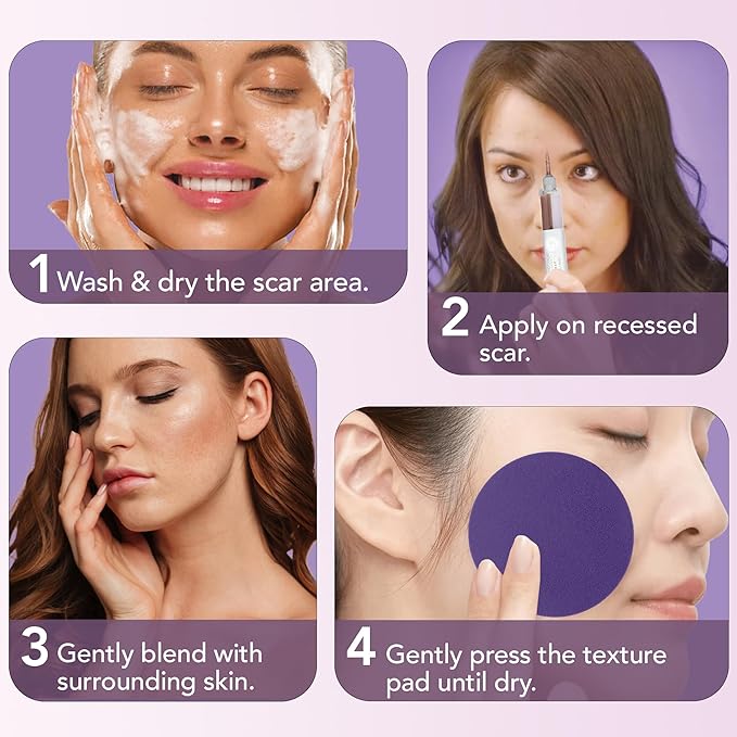 Dermaflage Scar Filler Kit - Deep - Deep Scar Cover and Waterproof Concealer for Acne Scars Wrinkles, and Ice Pick Scars Makeup, 1 mo supply-Velvo Beauty