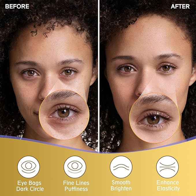 Under Eye Patches for Puffy Eyes and Dark Circles (20 Pairs), Under Eye Gold Mask with Hyaluronic Acid & Collagen to Reduce Wrinkles and Relieve Pressure, Eye Care Treatment for Men & Women Gift-Velvo Beauty