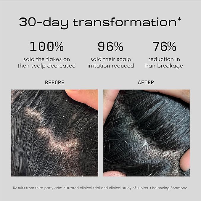 Jupiter, Physician-Formulated Anti-Dandruff Shampoo & Conditioner, for Flaky, Itchy, Oily, Dry Scalp, Vegan, Sulfate-Free, Color-Safe, & Paraben-Free, Dry Scalp Shampoo and Conditioner for Women & Men-Velvo Beauty
