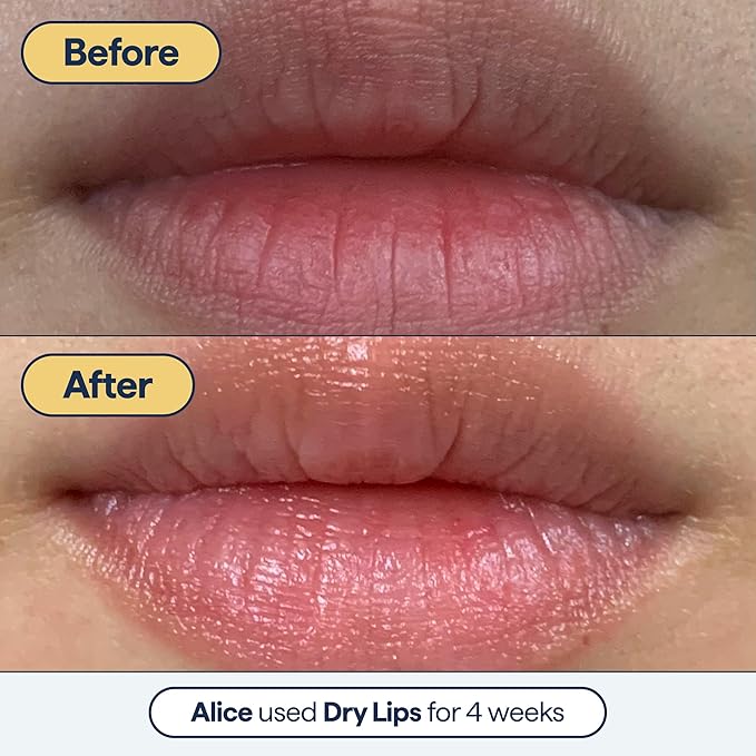 Remedy for Dry Lips - Hydrating and Healing Lip Balm Ointment with Ceramides, Peptides, and Dimethicone - Repairs Dry, Cracked Lips - By Dermatologist Dr. Shah-Velvo Beauty