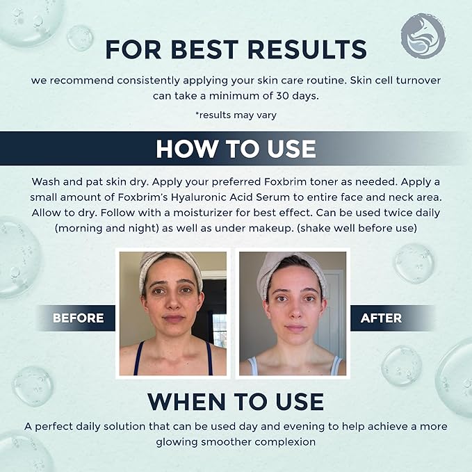 Hyaluronic Acid Face Serum - Hydrating Anti Wrinkle Anti Aging Facial Serum - With Vitamin C and E, Green Tea, Jojoba Oil - Natural and Organic - 1 Oz by Foxbrim Naturals-Velvo Beauty