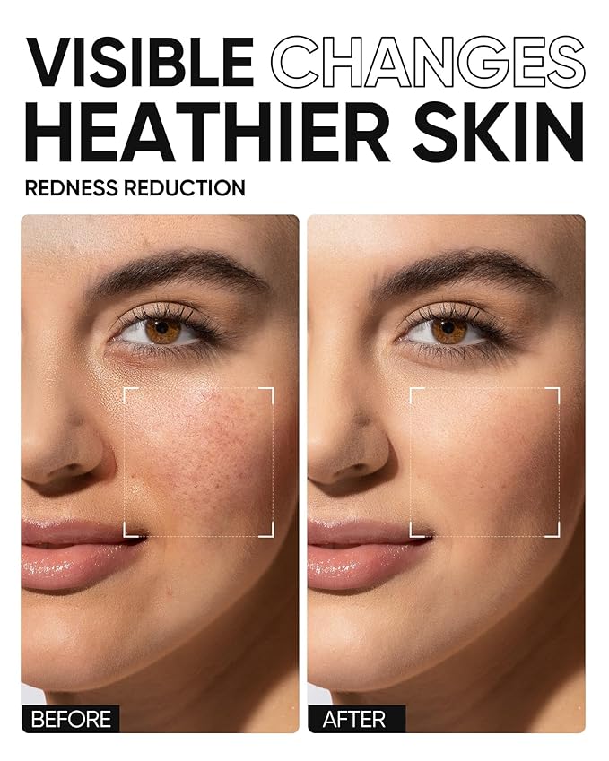 5X Ceramides Moisture Barrier Cream, Hydrating Skin Barrier Repair Face Moisturizer for All Skin Types with Hyaluronic Acid & Centella, Daily Moisturizer, Non-Comedogenic-Velvo Beauty