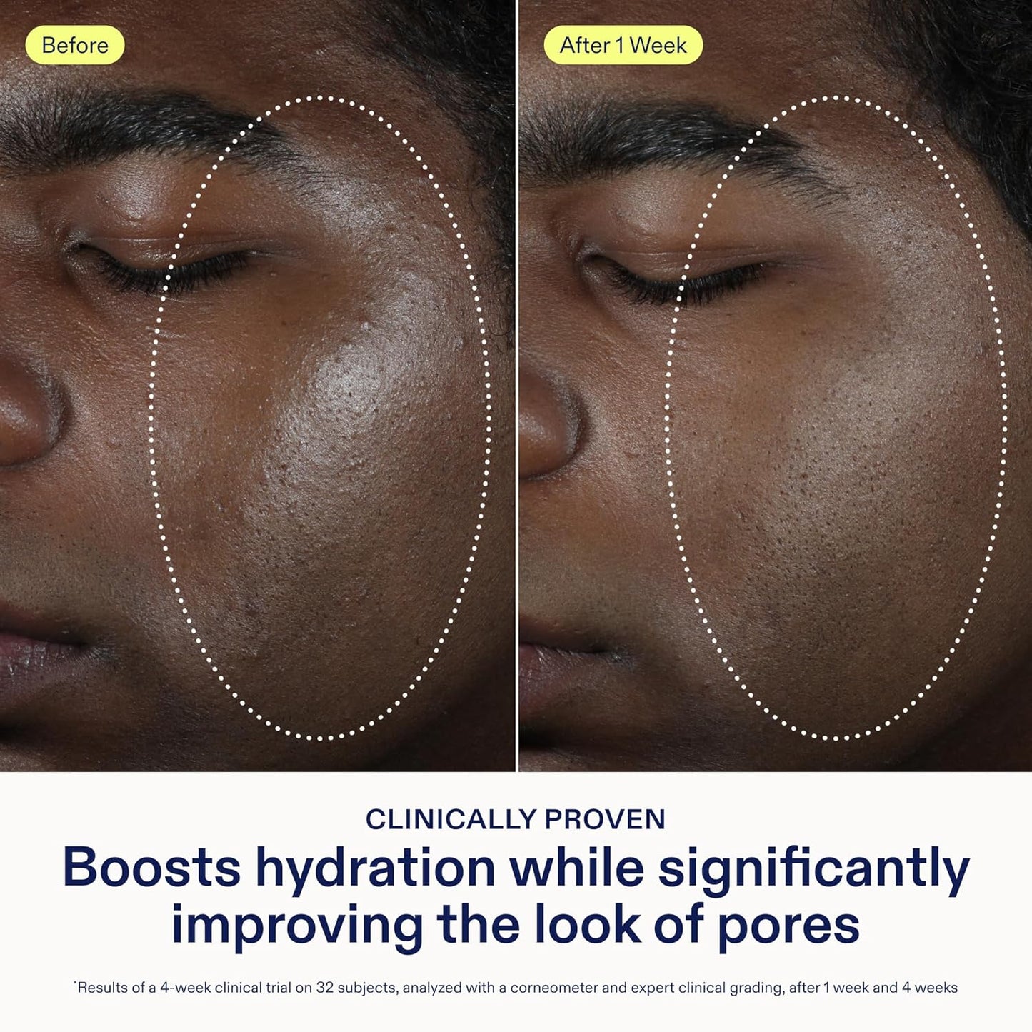 Skinfix Barrier Balancing Water Cream - 1.7 oz - Fast-Absorbing, Weightless Moisturizer for Combo + Oily Skin - Acne-Safe, Non-Pore-Clogging - Non-Comedogenic - Fragrance Free - Vegan, Cruelty Free-Velvo Beauty