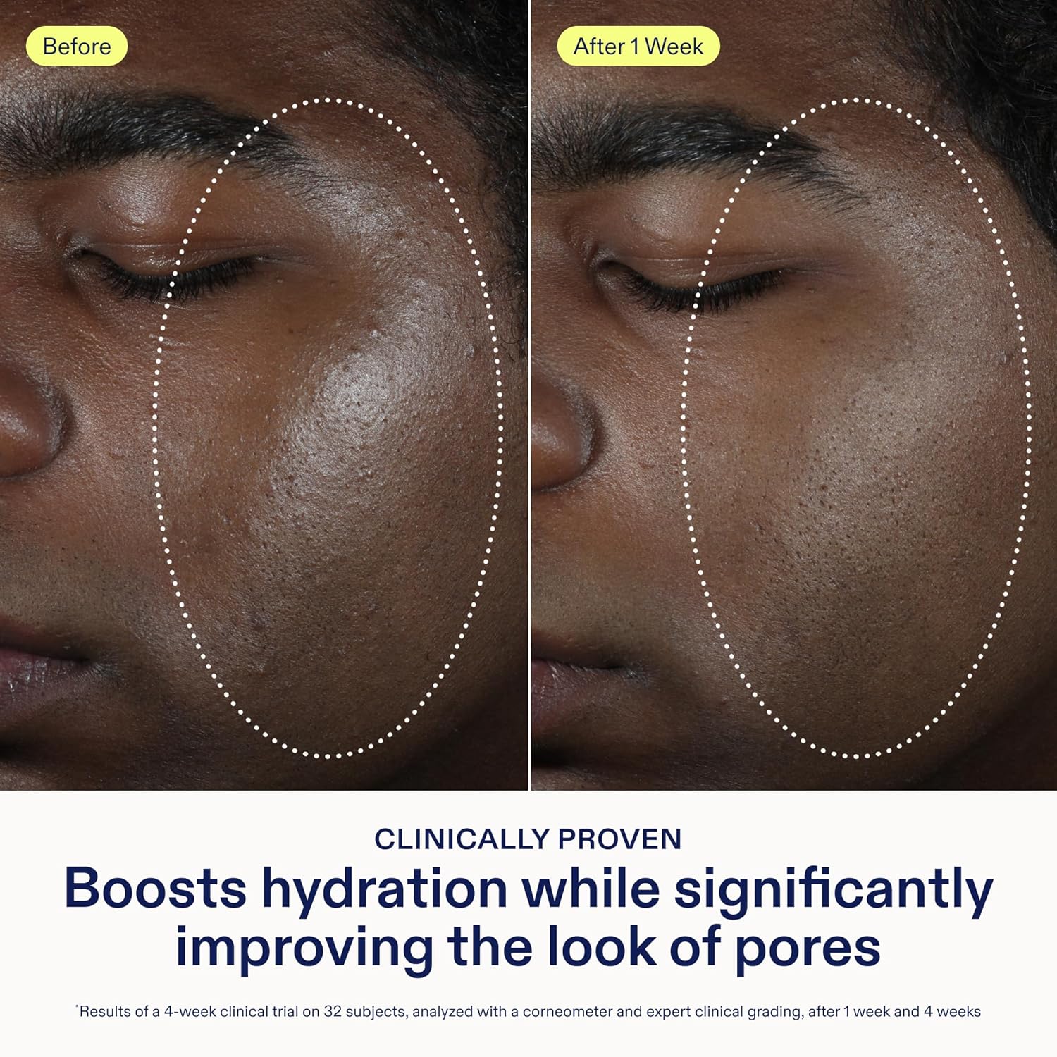 Skinfix Barrier Balancing Water Cream - 1.7 oz - Fast-Absorbing, Weightless Moisturizer for Combo + Oily Skin - Acne-Safe, Non-Pore-Clogging - Non-Comedogenic - Fragrance Free - Vegan, Cruelty Free-Velvo Beauty