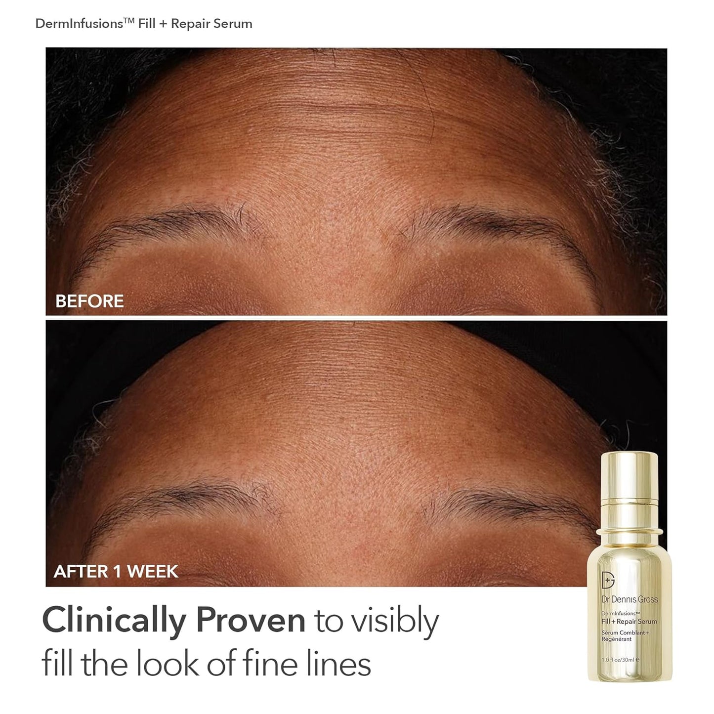 Dr. Dennis Gross Fill, Plump & Firm Kit – DermInfusions™ Hyaluronic Acid Serum, Eye Cream & Lip Treatment | Boost Hydration, Smooth Fine Lines & Enhance Volume | Limited Edition Gift Set-Velvo Beauty