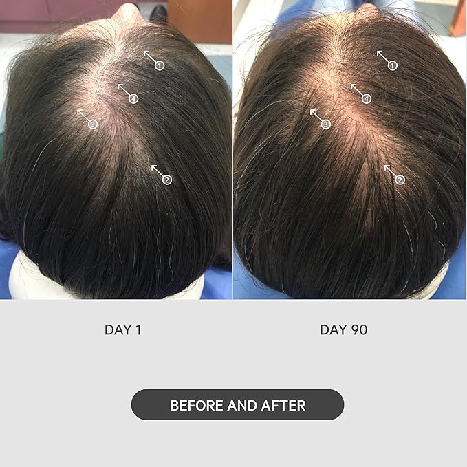 DS Labs StimuROLLER Hair Micro-Needle Hair Stimulation System 0.25mm, Packaging May Vary-Velvo Beauty