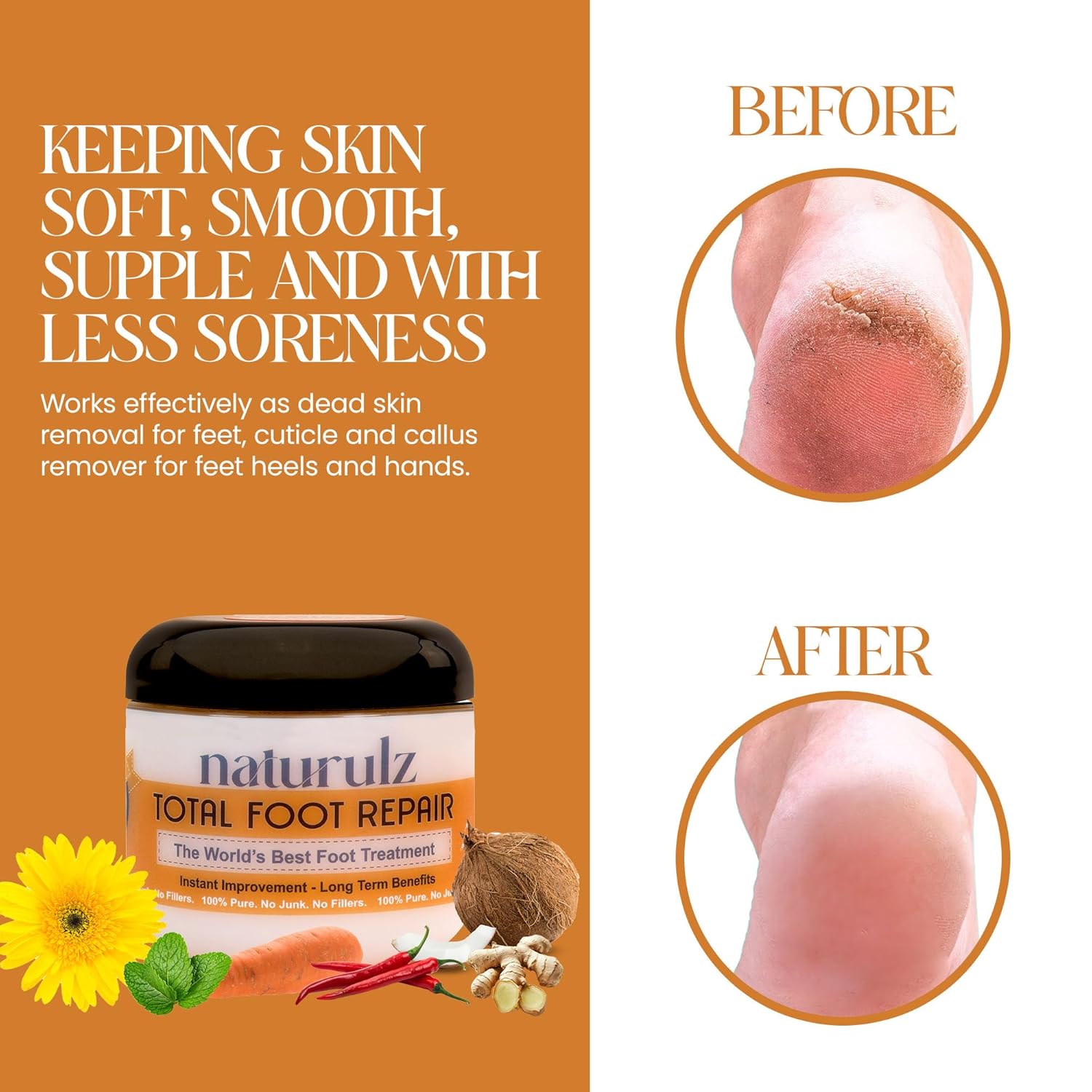 Naturulz Total Foot Repair 4oz – No Junk Foot Cream for Dry, Rough Skin & Cracked Heels, Lightweight & Compact Moisturizer for Feet, Knees, Elbows & Hands, Softens, Repairs & Smooths Cracked Skin-Velvo Beauty
