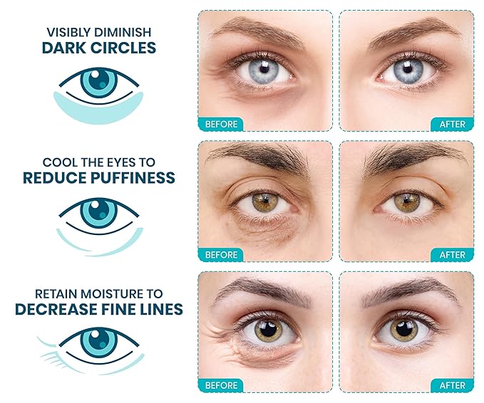 Stylia Under Eye Patches for Puffy Eyes and Dark Circles (6 Pairs) - Marine Collagen Under Eye Mask with Vitamin C, Hyaluronic Acid, Pearl Extract - Eye Masks for Dark Circles and Puffiness-Velvo Beauty