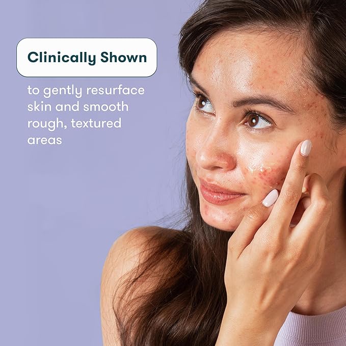 Proactiv Post Acne Scar Gel for Face with Antioxidants and vitamin E, Skin Smoothing Moisturizing - 1 oz.-Velvo Beauty