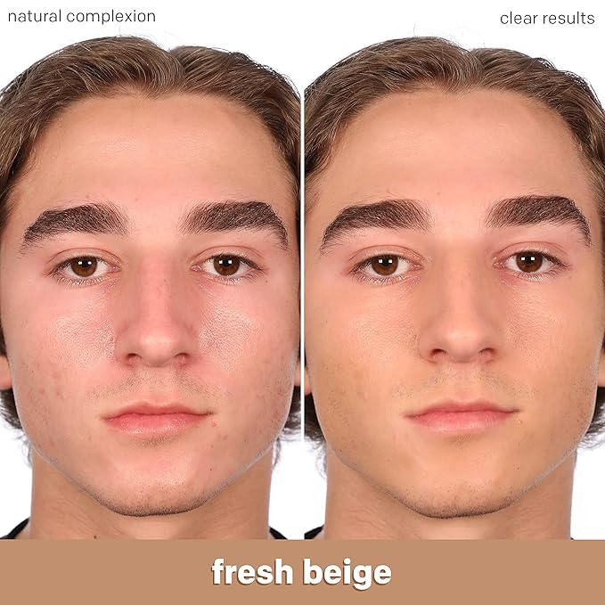 Almay Clear Complexion Acne Foundation Makeup with Salicylic Acid - Lightweight, Medium Coverage, Hypoallergenic, -Fragrance Free, for Sensitive Skin , 700 True Beige, 1 fl oz.-Velvo Beauty