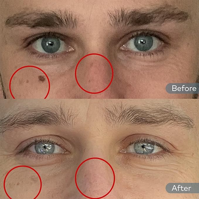 Onekind Dream Cream Night Moisturizer – Hydrating Anti-Aging Face Cream with Squalane, Rosehip & Shea Butter – Fragrance-Free, Vegan, for Dry & Sensitive Skin – 1.7 oz-Velvo Beauty