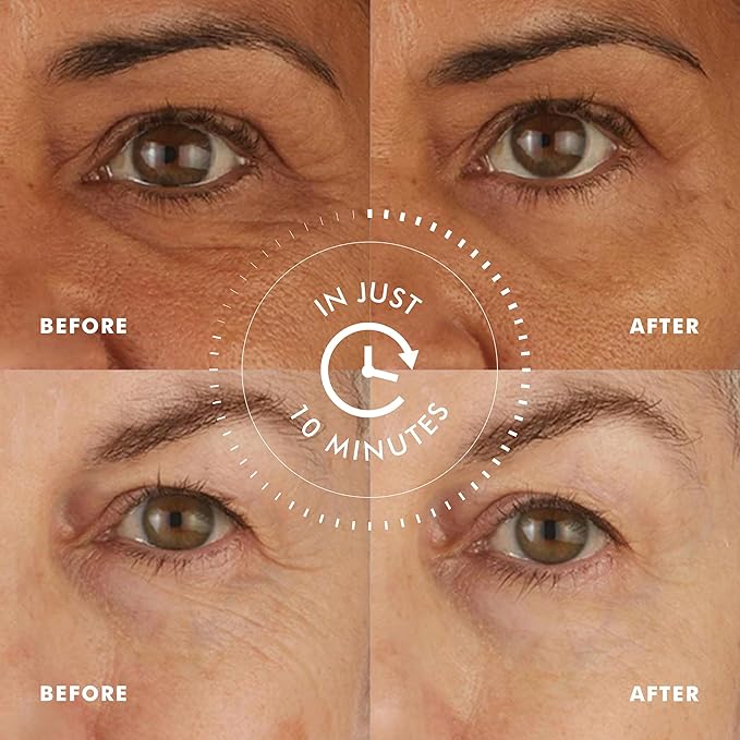 skyn ICELAND Hydro Cool Firming Under Eye Patches, Instant Cooling for Puffy, Tired Eyes with Peptides and Coenzyme Q10, 10 Minute Treatment, Vegan, All Skin Types, 4 Pairs-Velvo Beauty