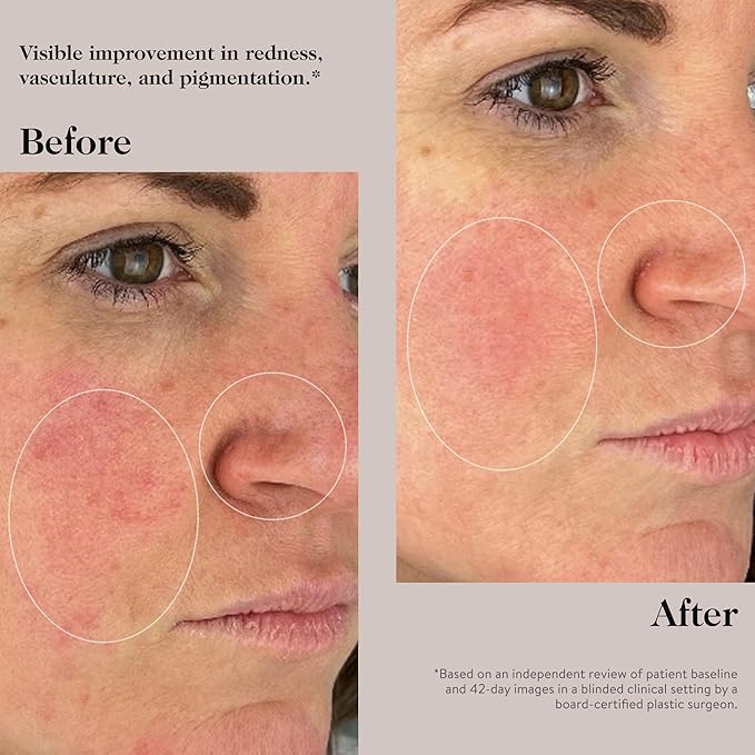 goop Beauty Peptide Serum |Reduces Fine Lines, Wrinkles, & Dark Spots | Peptides, Ceramides, & Niacinamide | Anti Aging Treatment to Improve Firmness & Elasticity | 1 fl oz-Velvo Beauty