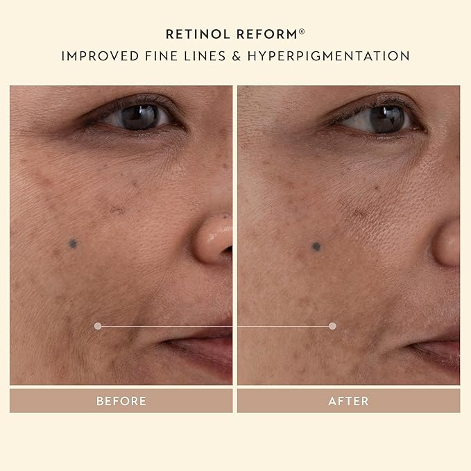 SHANI DARDEN SKINCARE Sculpt & Firm Travel Kit, Facial Sculpting Wand, Attachments, Retinol Reform & Lactic Serums, Peptide Cream & Pep Gel, 7 Items-Velvo Beauty