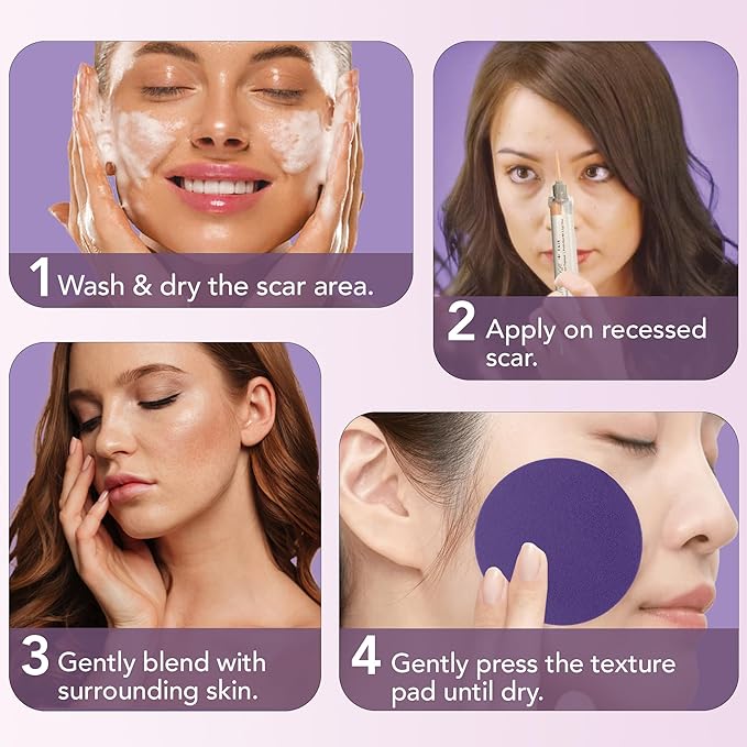 Dermaflage Scar Filler Kit - Medium - Deep Scar Cover and Waterproof Concealer for Acne Scars Wrinkles, and Ice Pick Scars Makeup, 1 mo supply-Velvo Beauty