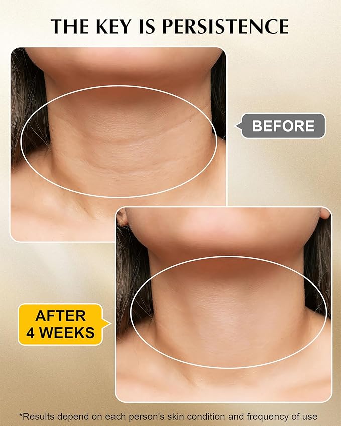 Neck Firming Cream with 3% Retinol - Hyaluronic Acid, Anti-Wrinkle Treatment, Skin Tightening Cream for Face, Neck, Chest & Décolleté-Velvo Beauty