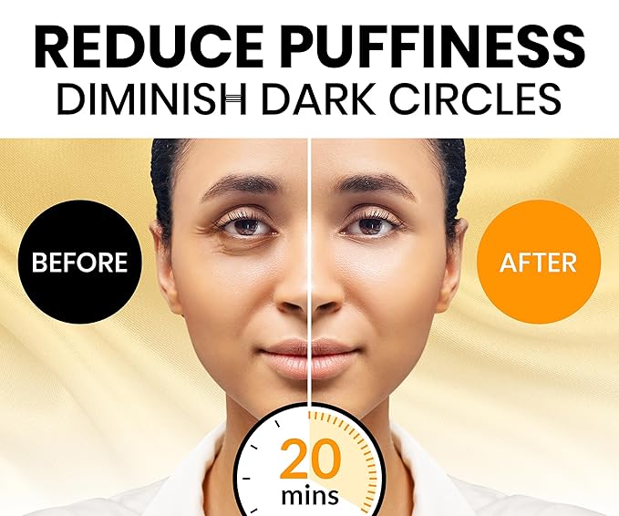 Stylia Under Eye Patches for Dark Circles and Puffy Eyes (30 Pairs) - 24k Gold Under Eye Mask with Vitamin C, Hyaluronic Acid, Pearl Extract - Eye Masks for Dark Circles and Puffiness-Velvo Beauty